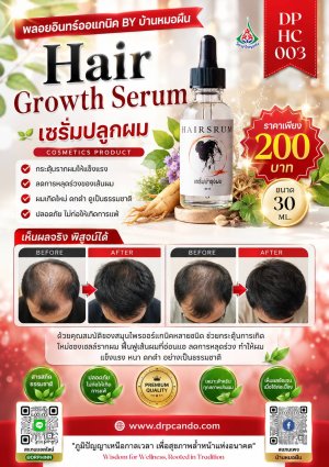 เซรั่มปลูกผม